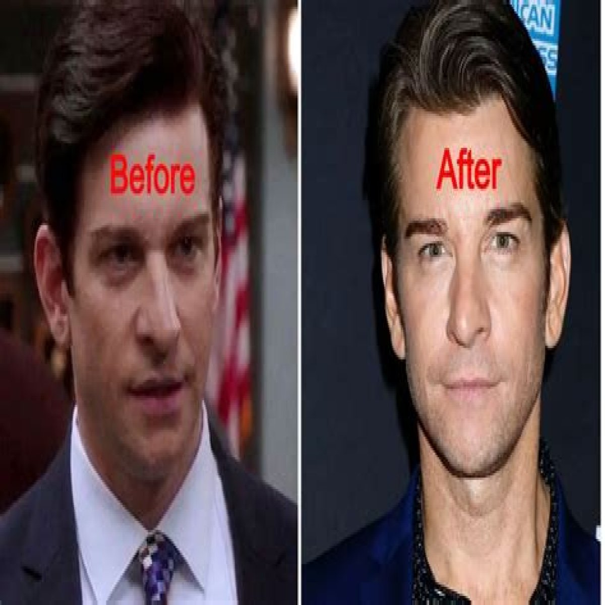 Did Blue Bloods Actor Andy Karl Plastic Surgery? Before and After Photos