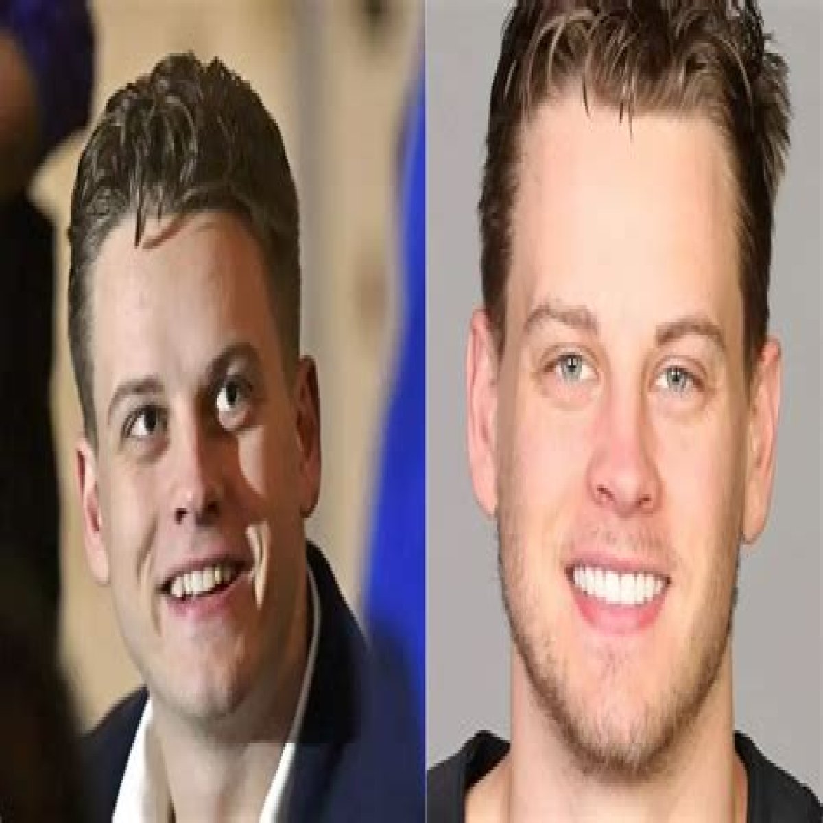 Joe Burrow Teeth Before And After: Did He Got New Tooth? Check Out Now